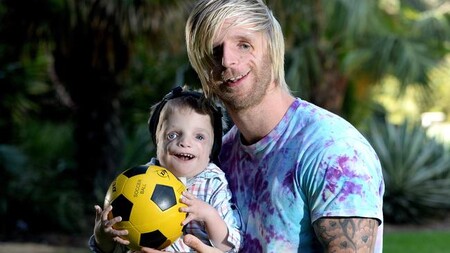 Sus padres lo abandonaron por su aspecto al nacer: la emotiva historia de superación de Jono Lancaster