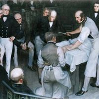 El pionero de la cirugía moderna hoy sería considerado un peligro: Robert Liston, "el cuchillo más rápido de Londres" 