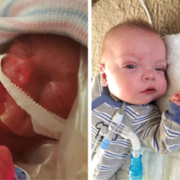 Uno de los bebés más pequeños del mundo se va a casa tras 307 días en el hospital