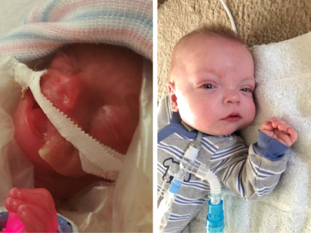 Uno de los bebés más pequeños del mundo se va a casa tras 307 días en el hospital