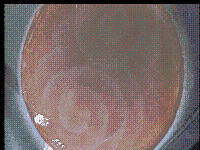 Gel pulsante