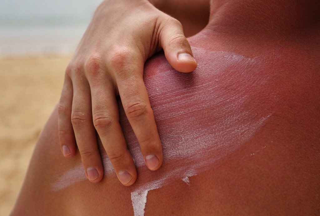 ¿Cuánto tiempo dura realmente la crema solar? Mi iPhone y esta web me dan la respuesta exacta para no quemarme