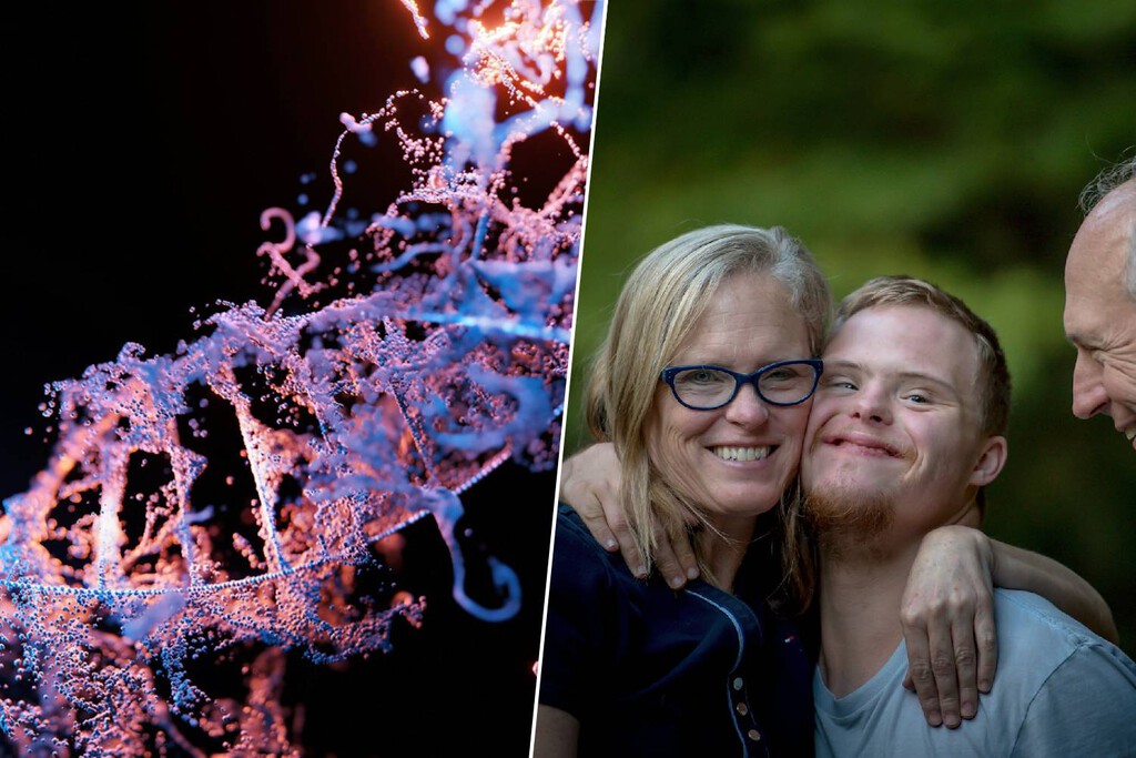 O interruptor genético: cientistas conseguem "desligar" o cromossomo extra da síndrome de Down