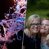 La ciencia ha logrado apagar el cromosoma extra del síndrome de Down. También ha abierto el gran debate ético sobre la edición génica 