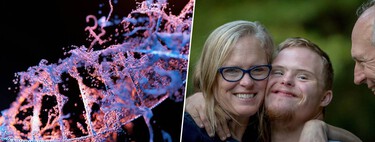 La ciencia ha logrado apagar el cromosoma extra del síndrome de Down. También ha abierto el gran debate ético sobre la edición génica 