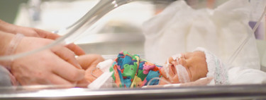 Una buena noticia: en España, el 95% de los bebés prematuros nacidos después de la semana 28 sobrevive