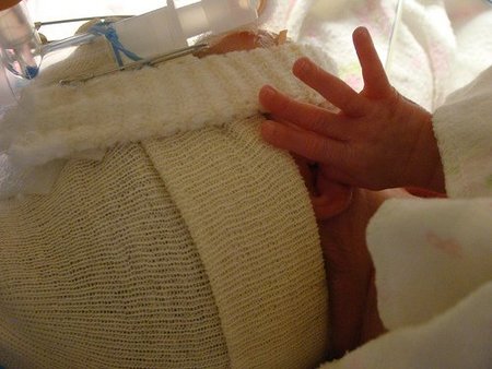 Lo que puede hacer Europa por los bebés prematuros