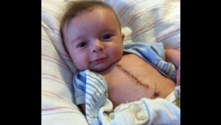 Publica una foto de su sobrino operado y los miles de apoyos dan "vida" a los padres