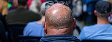 Esqueça os implantes caros: a ciência acaba de validar o "tesouro" chinês inesperado que promete reverter a calvície 