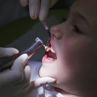 Alerta caries: demasiados niños sacian su sed con bebidas que no son agua