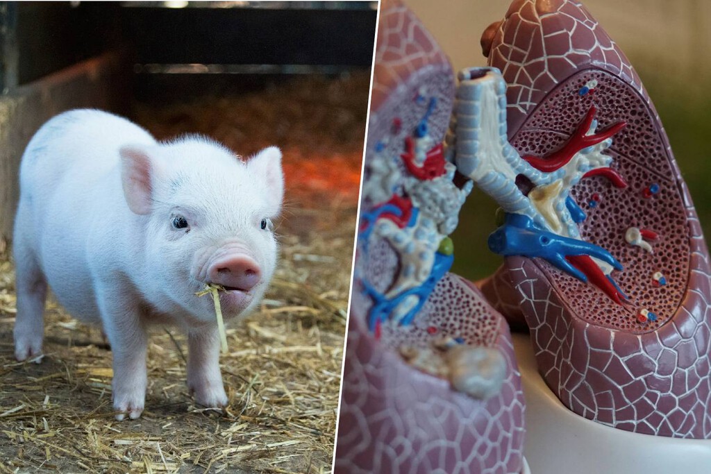 El primer ser humano con un pulmón de cerdo ya existe: es el inicio de una gran revolución en los trasplantes 