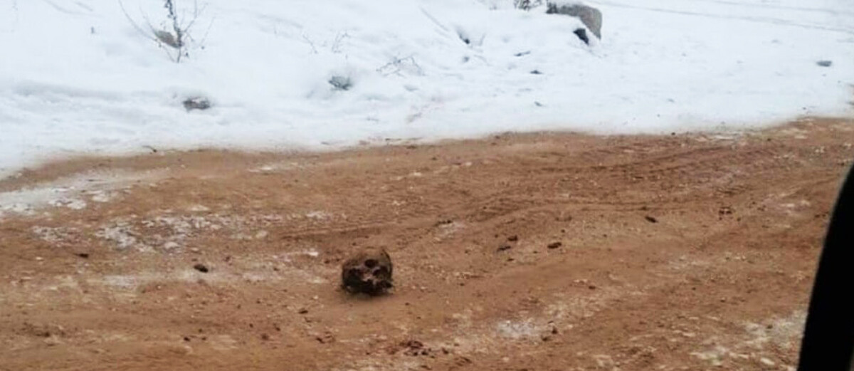 Человек в песке на пляже. Одуванчики засыпанные песком. Дети закапываются в песок. Жук в песке. Глаза засыпанные песком.