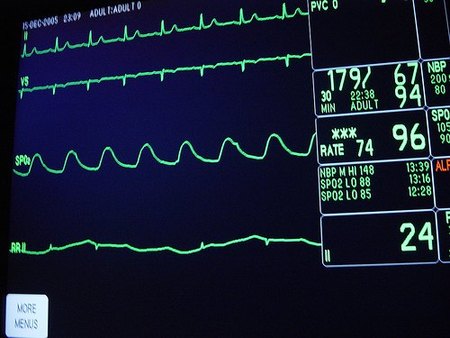 El copago sanitario: el siguiente globo sonda
