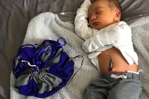 Nacimiento lotus: deja a su bebé unido a la placenta durante nueve días después de nacer