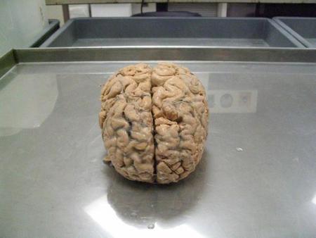 Gastamos 1.200 euros de energía para alimentar a nuestro cerebro