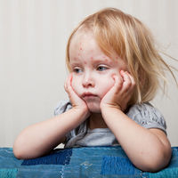 Varicela e ibuprofeno: por qué no se recomienda dar este medicamento durante la enfermedad