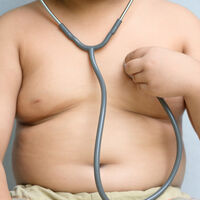 Los niños con un percentil de IMC superior al 95 son más propensos a padecer enfermedades cardiovasculares