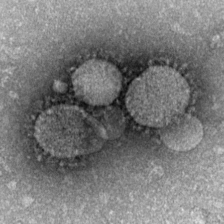 MERS, el virus mortal que ha saltado de los camellos a los seres humanos