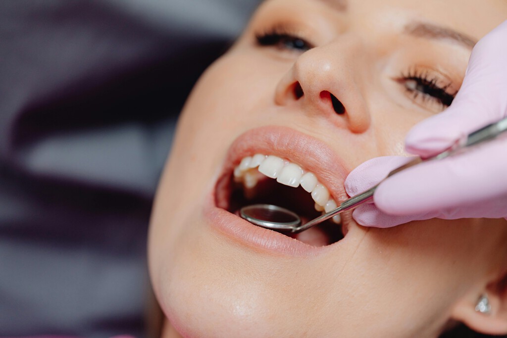¿Es posible revertir las caries dentales? Esto es lo que dice la ciencia 