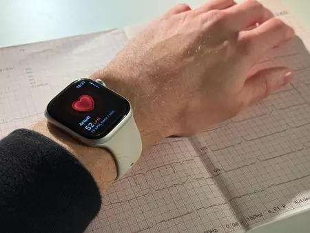 Apple Watch Apple Watch