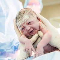 ¿Quieres sacar a tu bebé con tus propias manos en la cesárea? Una madre lo hace y lo documenta en fotos