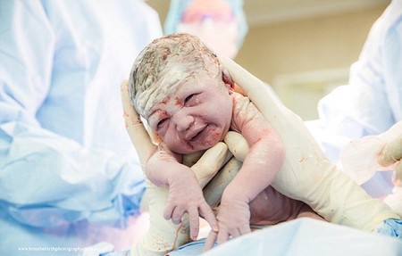 ¿Quieres sacar a tu bebé con tus propias manos en la cesárea? Una madre lo hace y lo documenta en fotos