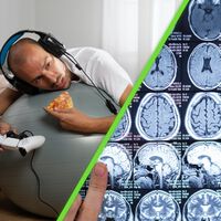 Los infartos cerebrales van en aumento entre los jóvenes de México: estos hábitos modernos son las principales causas