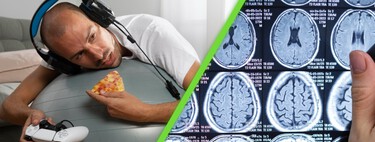 Los infartos cerebrales van en aumento entre los jóvenes de México: estos hábitos modernos son las principales causas
