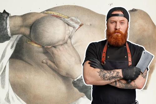 La primera cesárea exitosa de la historia no la hizo un médico: fue un carnicero para que naciera su hijo en el siglo XVI