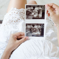 Crecimiento intrauterino retardado: qué consecuencias tiene que el bebé crezca menos de lo normal en el embarazo