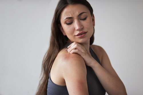 Mujer Que Sufre De Erupcion