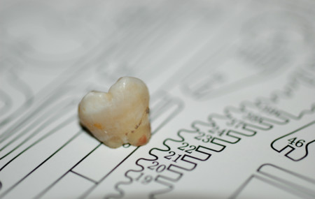 Unos dientes muy blancos no son síntoma de buena salud bucodental