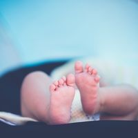 El bebé tiene displasia de cadera: qué es y cómo se corrige