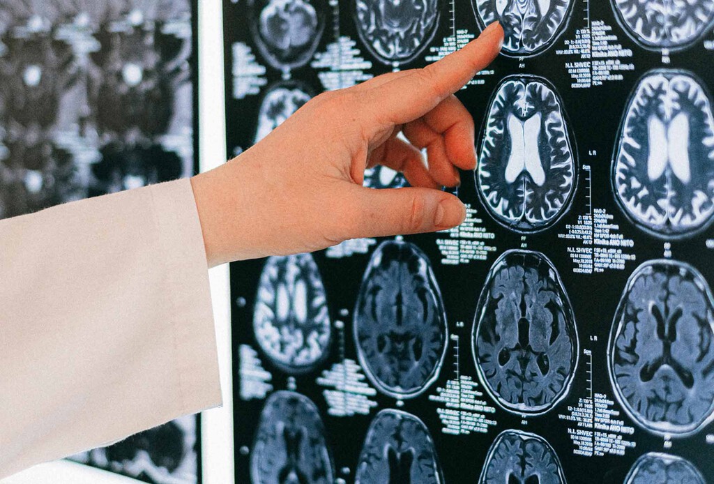 Nuestro cerebro tiene su propia copia de seguridad. Ya se conoce cómo crea copias en paralelo de cada recuerdo