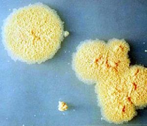 ¿Una bacteria podría haber aumentado la inteligencia de la humanidad?