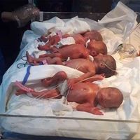 Una madre con tres hijos da a luz septillizos en Irak, seis niñas y un niño