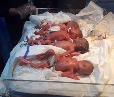 Una madre con tres hijos da a luz septillizos en Irak, seis niñas y un niño