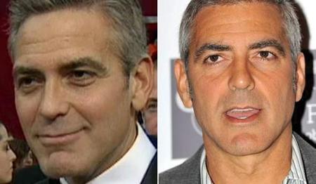 ¿George Clooney se ha operado para quitarse las bolsas de debajo de los ojos?