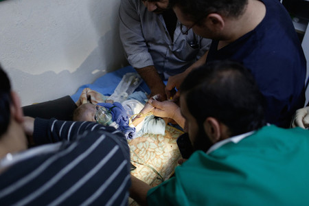 Médico operando a un bebé con la luz de su teléfono