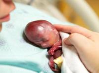 Un bebé nacido con 19 semanas vivió apenas unos minutos pero recibió todo el amor de su familia 