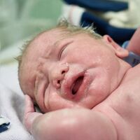 Síndrome de aspiración de meconio en el recién nacido: qué es y qué riesgos supone