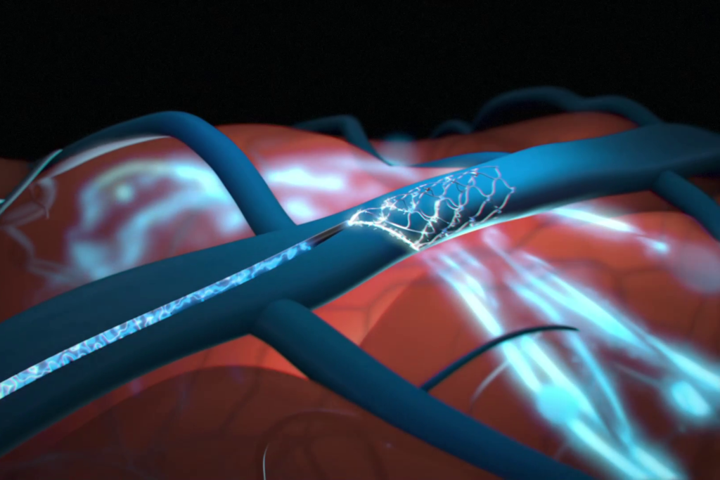 Neuralink es la empresa más reconocida en el sector de los interfaces cerebro-ordenador. No es, ni mucho menos, la única