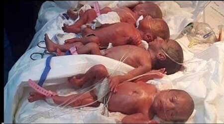 Una mujer de Mali que esperaba septillizos dio a luz a nueve bebés