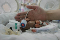 Sobrevive bebé china de 413 gramos y 26 centímetros