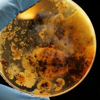 Las superbacterias son la punta del iceberg: nuestra mayor problema epidemiológico son los "superhongos"