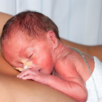 "Mi hijo vino al mundo antes de tiempo para salvarme la vida": la conmovedora historia de una madre y su bebé prematuro