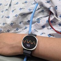 El Galaxy Watch ya es capaz de anticiparse a uno de los mayores sustos de salud y avisarte antes de que te desmayes 
