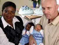 Mellizos con distinto color de piel