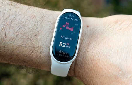 Xiaomi Smart Band 10