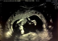 Diario de mi tercer “embarazo”: las primeras sensaciones